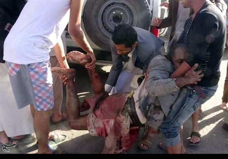 صنعا میں مجلس عزا پر سعودی عرب کا وحشیانہ حملہ