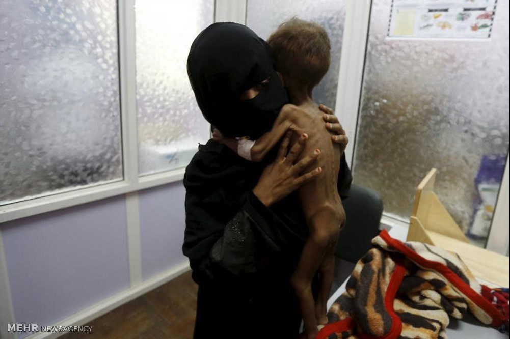 یمن میں قحط اور بھوک مری