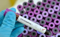۱۲۰۹ مورد جدید ابتلا به ویروس کرونا | ۴۷۹۰ نفر از مبتلایان بهبود یافتند