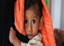 ۲۰۲۰؛ سالی مرگبار و هولناک برای کودکان یمنی