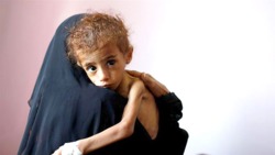 هشدار سازمان ملل درباره خطر گرسنگی در یمن