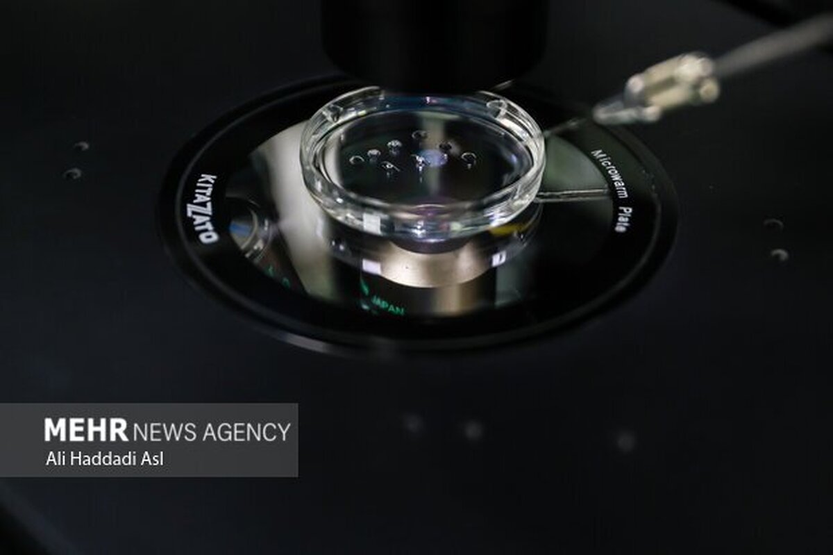 فریز و تعیین جنسیت جنین، راهکاری برای باروری هدفمند