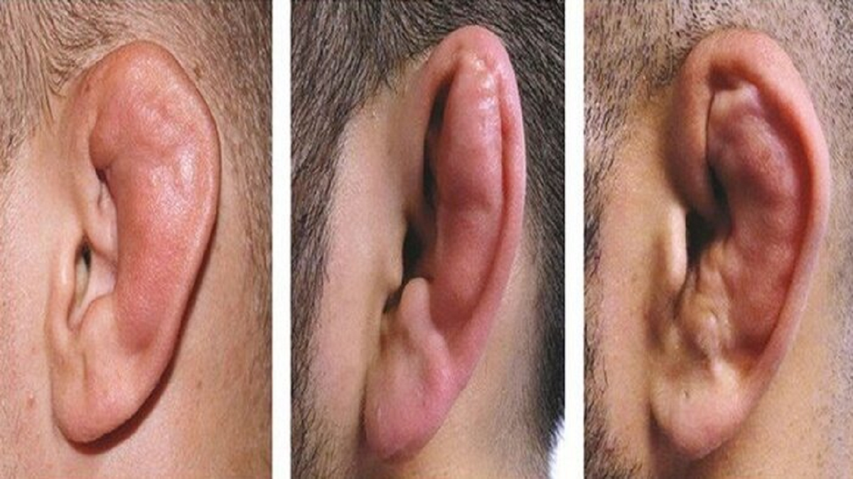 چند میگیری گوش بشکنی؟