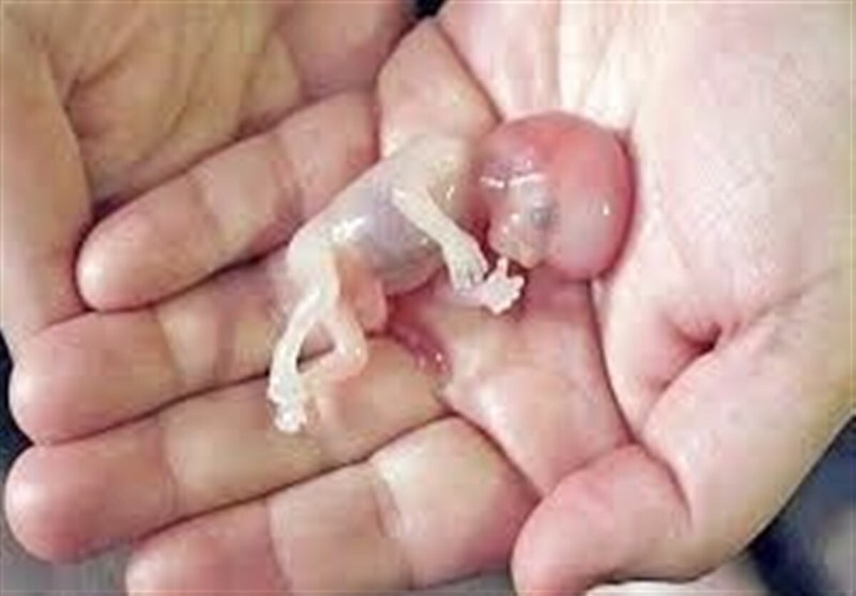 سقط جنین تنها در چارچوب قانون و با احراز شرایط مشخص مجاز است