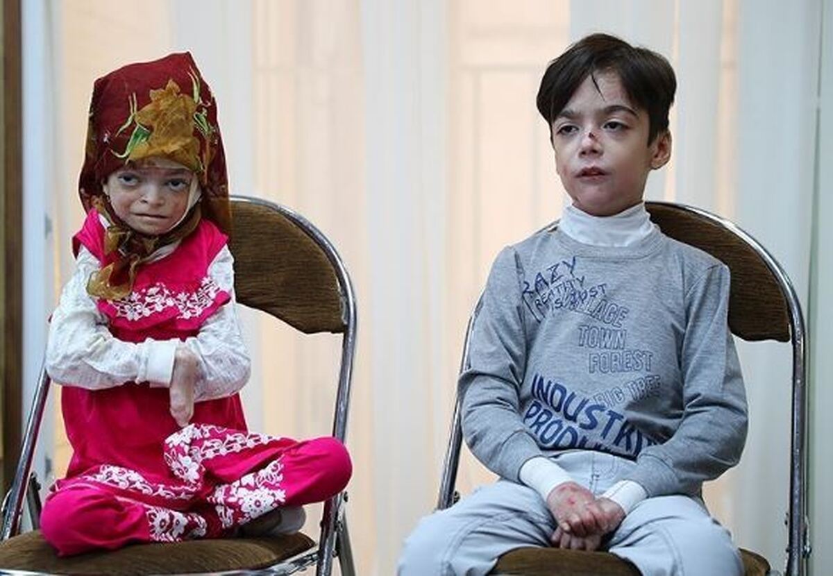 تخمین وجود ۳ میلیون بیمار نادر در کشور/ عدم‌اجرای سند ملی بیماری در ۳ دولت